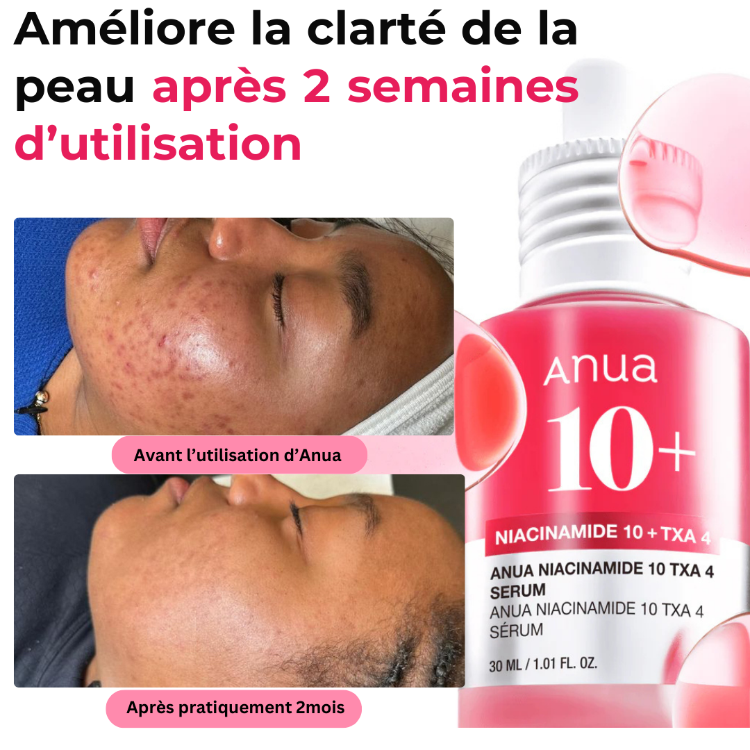 Serum Anua 10% de Niacinamide et  4% d'acide Tranexamique